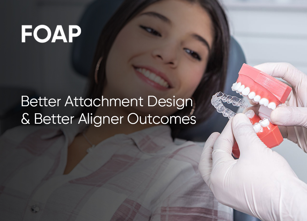 Attachment Design in Aligners: When, Where and Why It Matters