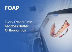 What Went Wrong: A Failed Aligner Case Breakdown